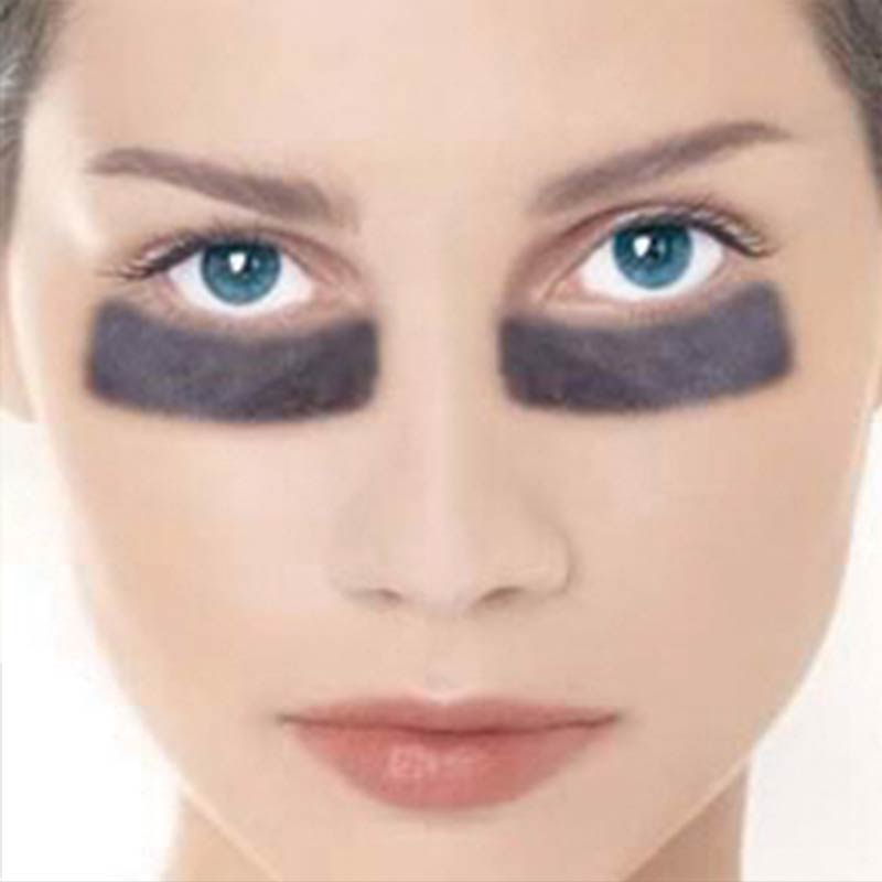 reduce eye bags food nutrition